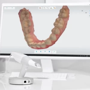 Visit Bradenton Orthodontics 3D scanner