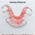 Visit Bradenton Orthodontics retainers